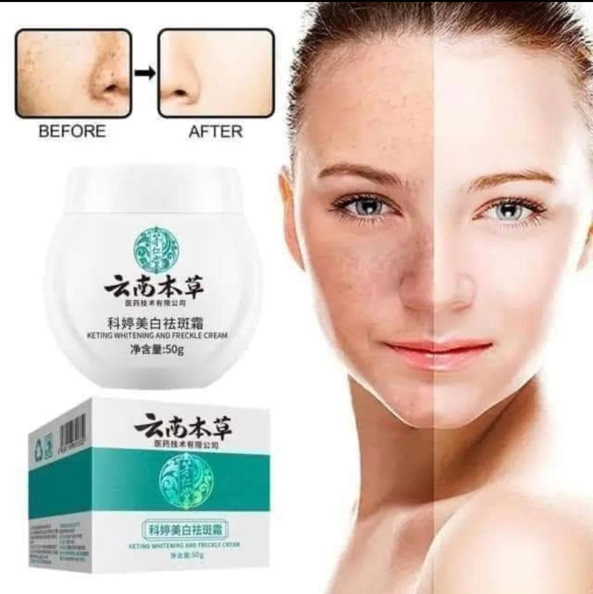 Dr. Hancy Melasma Removal Cream thumbnail 2