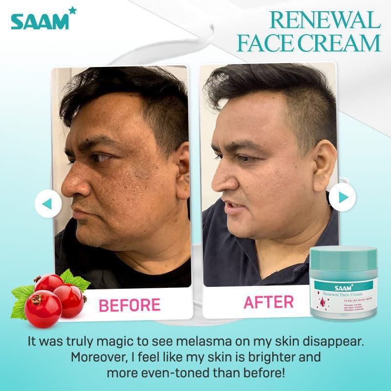 SAAM Face Renewal Whitening Cream – Instant Glass Skin thumbnail 1